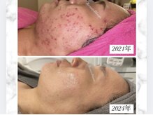 ビューティーブルーム(BeautyBloom)の雰囲気（本気の肌質改善★綺麗なって自信が持てる肌に変わる♪）