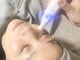 アルス(ars)の写真/【毛穴レスなうる艶肌へ】プラズマで毛穴の黒ずみや詰まりを解消！ニキビケア、美白、保湿、ハリツヤUP♪