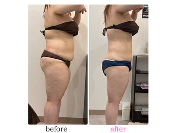 ニコリー(nicoly)