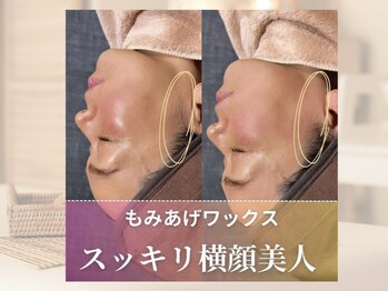 ホワイトワックス つくば店(WHITE WAX)/揉み上げワックス症例