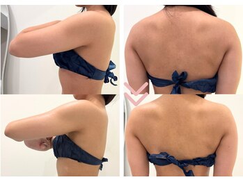 フロリール アザブジュウバン(FlorirAzabujuban)/痩身/ブライダル/オーダーメイド