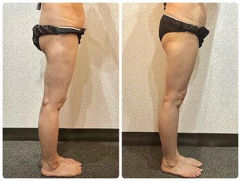 美容整体ウェリナ 名駅院/小顔矯正/骨盤矯正/美脚サロン