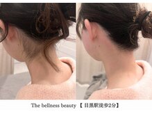ザ ベルネス(The bellness)/【うなじワックス】東京/目黒駅