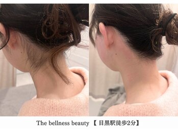 ザ ベルネス(The bellness)/【うなじワックス】東京/目黒駅