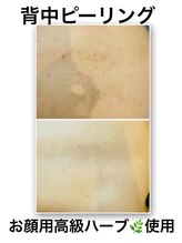 ママナ(mamana)/人気のハーブピーリング