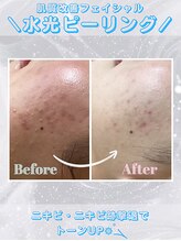 レイビス 盛岡店(RAYVIS)/最新韓国式肌管理