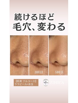 ジヒカ(ZIHICA)/【肌育フルコース】