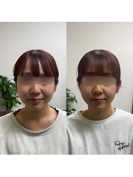 悠々整体院/筋膜小顔