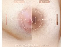 ビューティ サロン ココ ア ドール(Coco a Doll)の雰囲気（今大人気の韓国シェアNo.1メラニンケアの【ルメラ】導入店舗）
