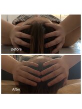 トータルビューティ リライフ(Total beauty Relife)/頭筋膜リリース