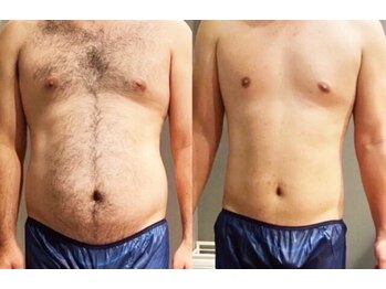 アネル 豊見城(anel)/