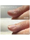 最強ネイルケアコース