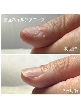 ネイルブルームーン(Nail Blue Moon)/最強ネイルケアコース