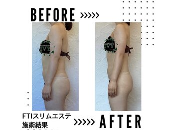 シェリアン バイ アイビー(Cherien by IVY)/痩身No.1 FTIスリム