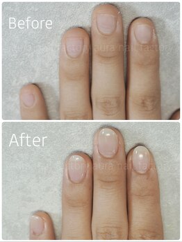アウラ ネイル ファクトリー(aura nail factory)/深爪矯正スカルプ長さだし自爪風