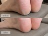 【ガサガサかかと改善◎】極上フットケア