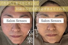 センシズ(Senses)