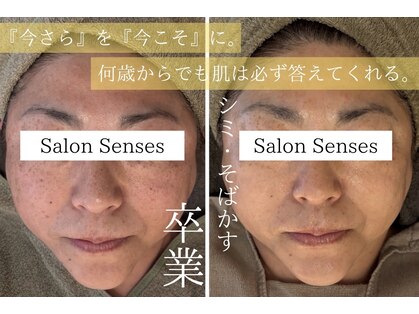 センシズ(Senses)の写真