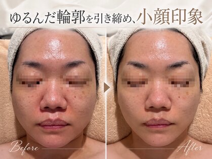 ハナイロ(hana-iro)の写真