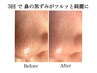 【いちご鼻/毛穴汚れに】メルティングケアでつるんとなめらか肌60分￥18,480→