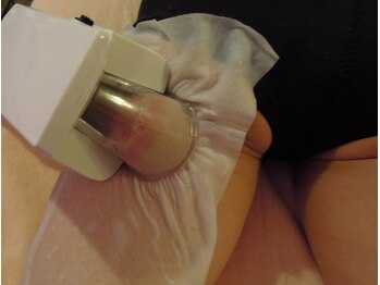 ビューティースタイル工房 ワントゥワン 京橋店(ONE to ONE)/【4℃脂肪冷却痩身◇ColDrop】