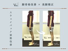 ビース(Ves)/美しい姿に