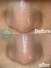 ストック(stock)/