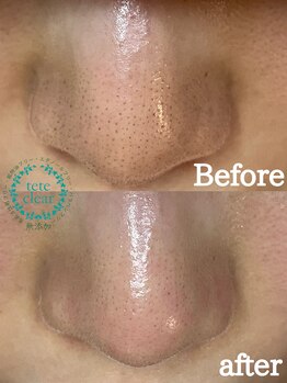 ストック(stock)/