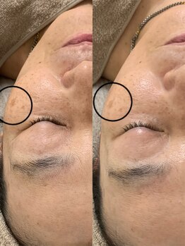 ニコ(25)/ラミピール