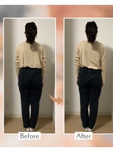藤沢南口整体サロン/20代女性 骨盤が戻りました！