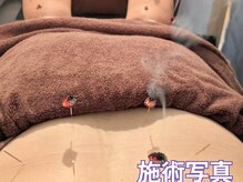 カンワ美容鍼灸院(KANWA美容鍼灸院)/辛い腰痛にも