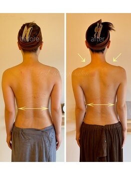 パル コルギサロン(Pal. Korugi salon)/コルギビフォーアフター