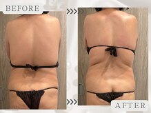 エステティックサロン ラ ベルタ(Esthetic Salon La Belta)/美骨ケア+セルライトゼロ3回