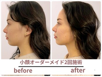 サボラミ(sabor A Mi)