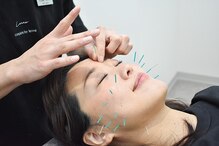 コガオ レンネ(Lenne)