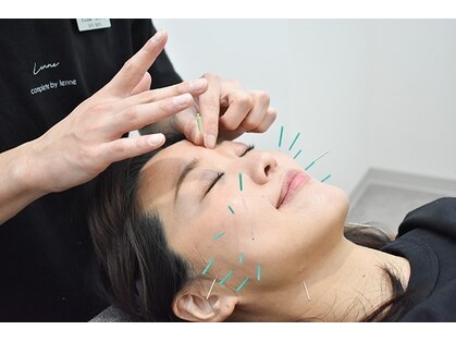 コガオ レンネ(Lenne)の写真