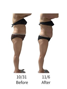 ララナ バイ カノア(LALANA by kanoa)/