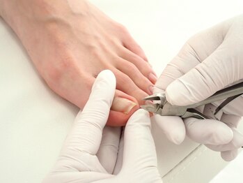 巻き爪ケアサポート ルアナ(LUANA)の写真/[足のお悩み改善]巻き爪、肥厚爪にお悩みの方に◎お得な価格設定で通いやすい！初めての方向け爪切りケア♪