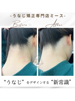 ミース 長野店/うなじ矯正◆ビフォーアフター