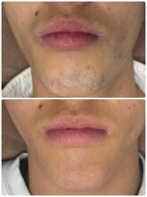 シック 南風原店(Chic)/他店からの乗り換えご相談下さい