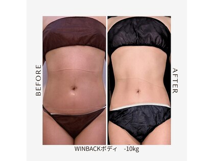 ワイビューティ(Y.Beauty)の写真