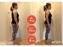 アイヴィー(IVY)/K様 ２ヶ月ビフォーアフター