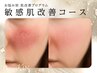 《フローラ会員様》お悩み別 肌改善プログラム／敏感肌改善コース