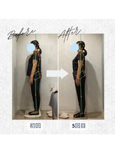 ラクリエ 東加古川院(La Creer)/お客様ビフォーアフター