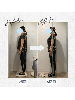 ラクリエ 東加古川院(La Creer)/お客様ビフォーアフター