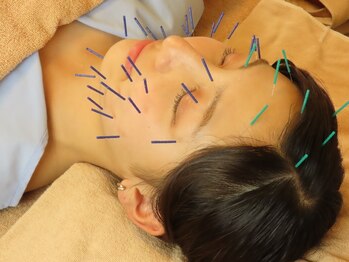 エグボッグ 恵比寿(EGBOK)の写真/【本気の肌質改善】限定クーポン多数ご用意あり！美容鍼8,000円も大人気◎お友達＆カップルで是非♪