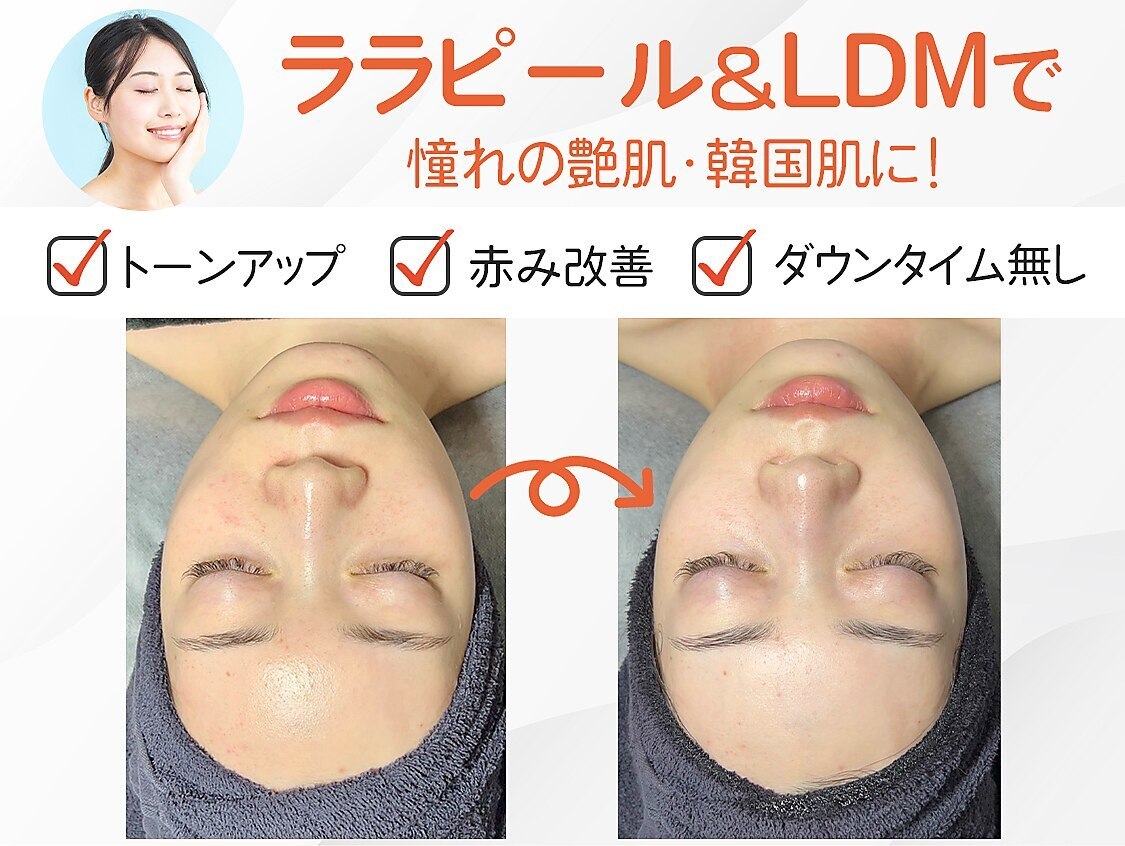 C049290576.jpg?impolicy=