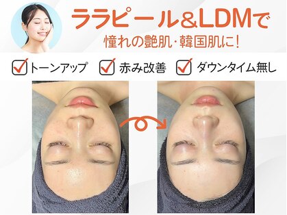 和歌山ララピール&韓国肌管理専門店の写真