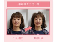 グリーンノア鍼灸院の雰囲気（お着替えの準備もございます。）