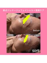 レアナ(LEANA)/50代　美点ドレナージュ　首肩